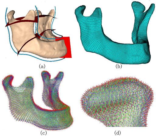 流线型生物力学建模工具建立下颌骨正交各向异性四面体有限元模型格模